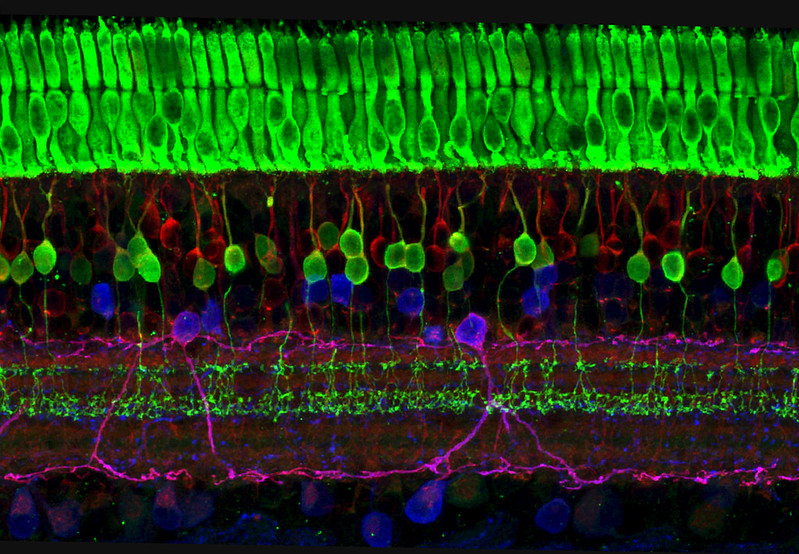 rods and cones from NIH 