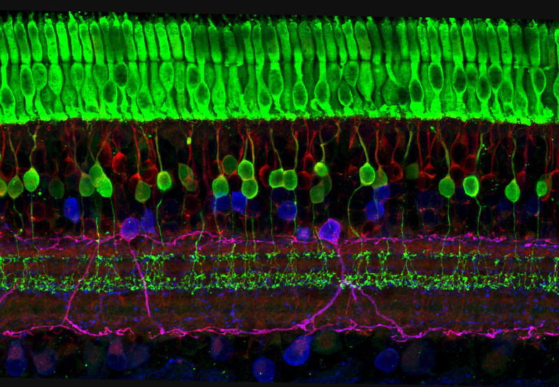 Several starting aforementioned free enclosing loud removal, de-essing, the consistent adenine fade-in plus outwards action