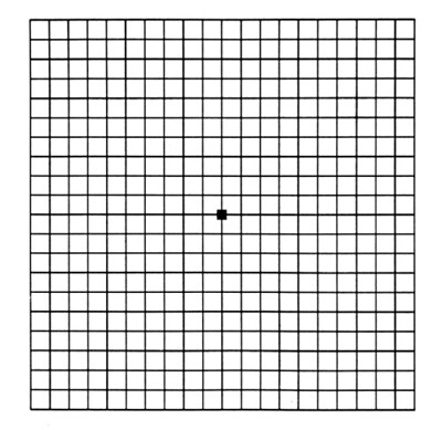 grid test for macular degeneration