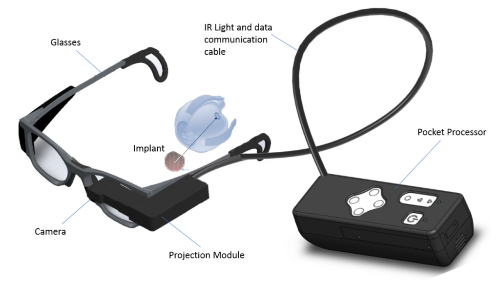 Macular Degeneration Treatment Breakthrough Improves Lost Vision