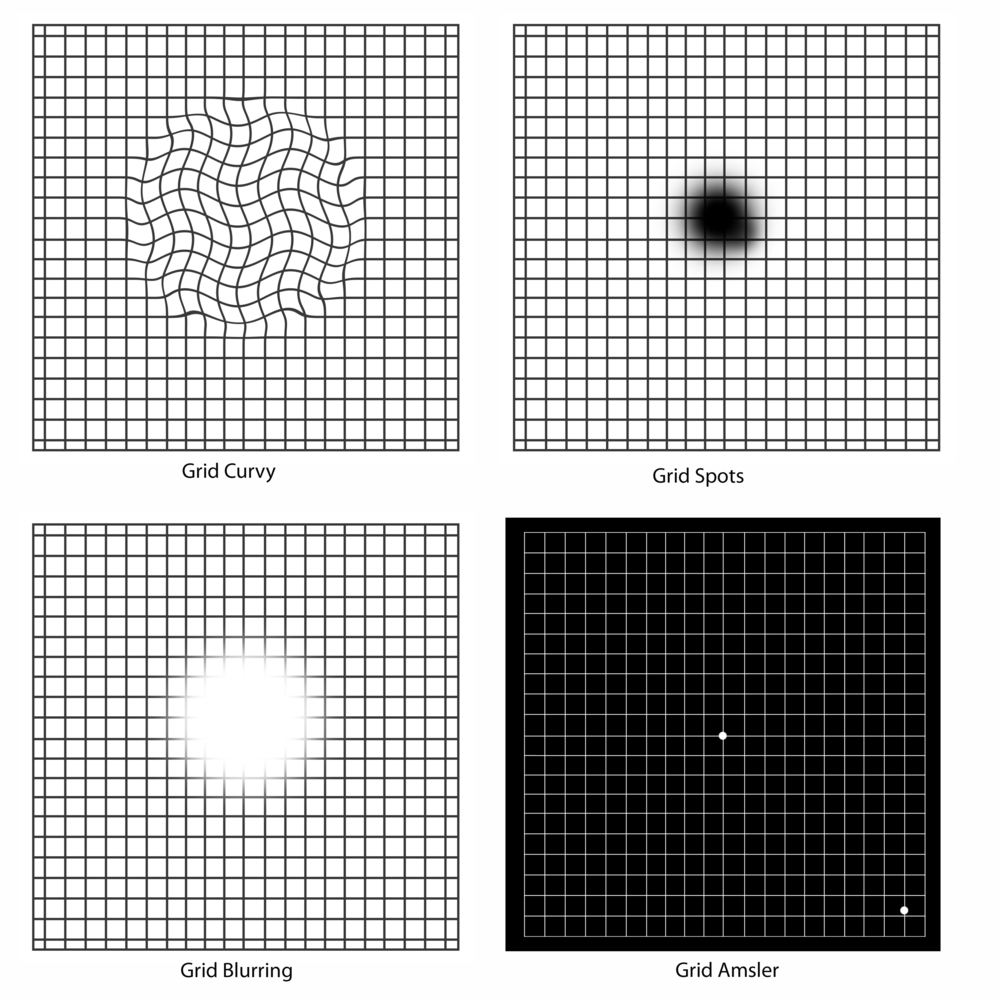 Amsler Chart to Test Your Sight  American Macular Degeneration Foundation