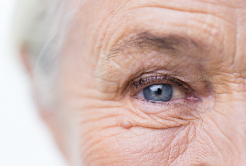 treatment for wet macular degeneration