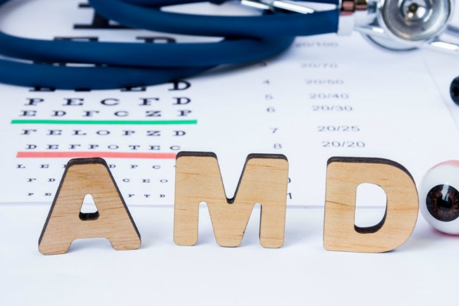 macular degeneration stages