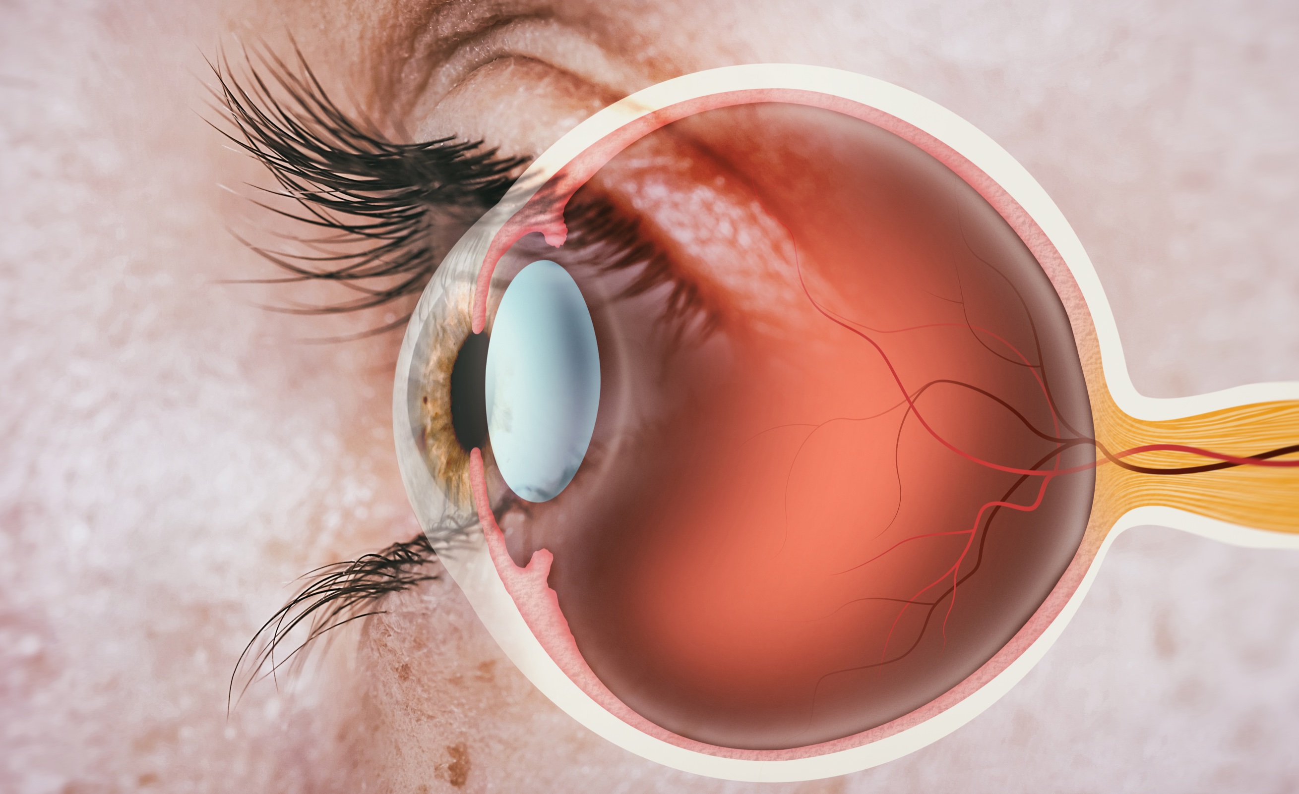 dry macular degeneration research
