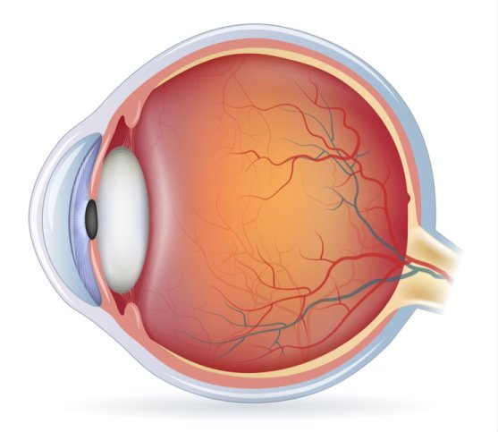 macular drusen