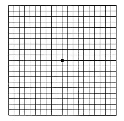 grid test for macular degeneration