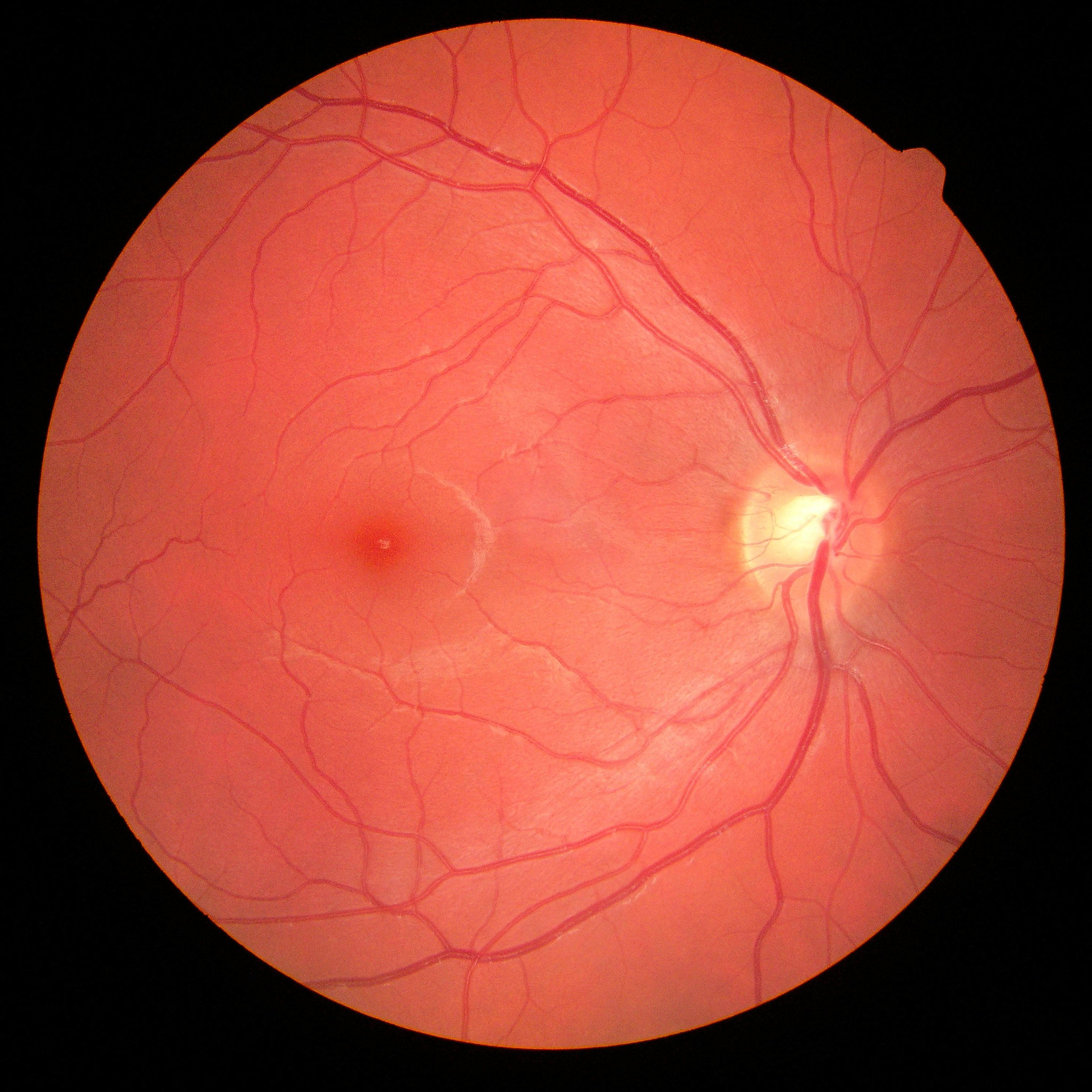 macular pigment