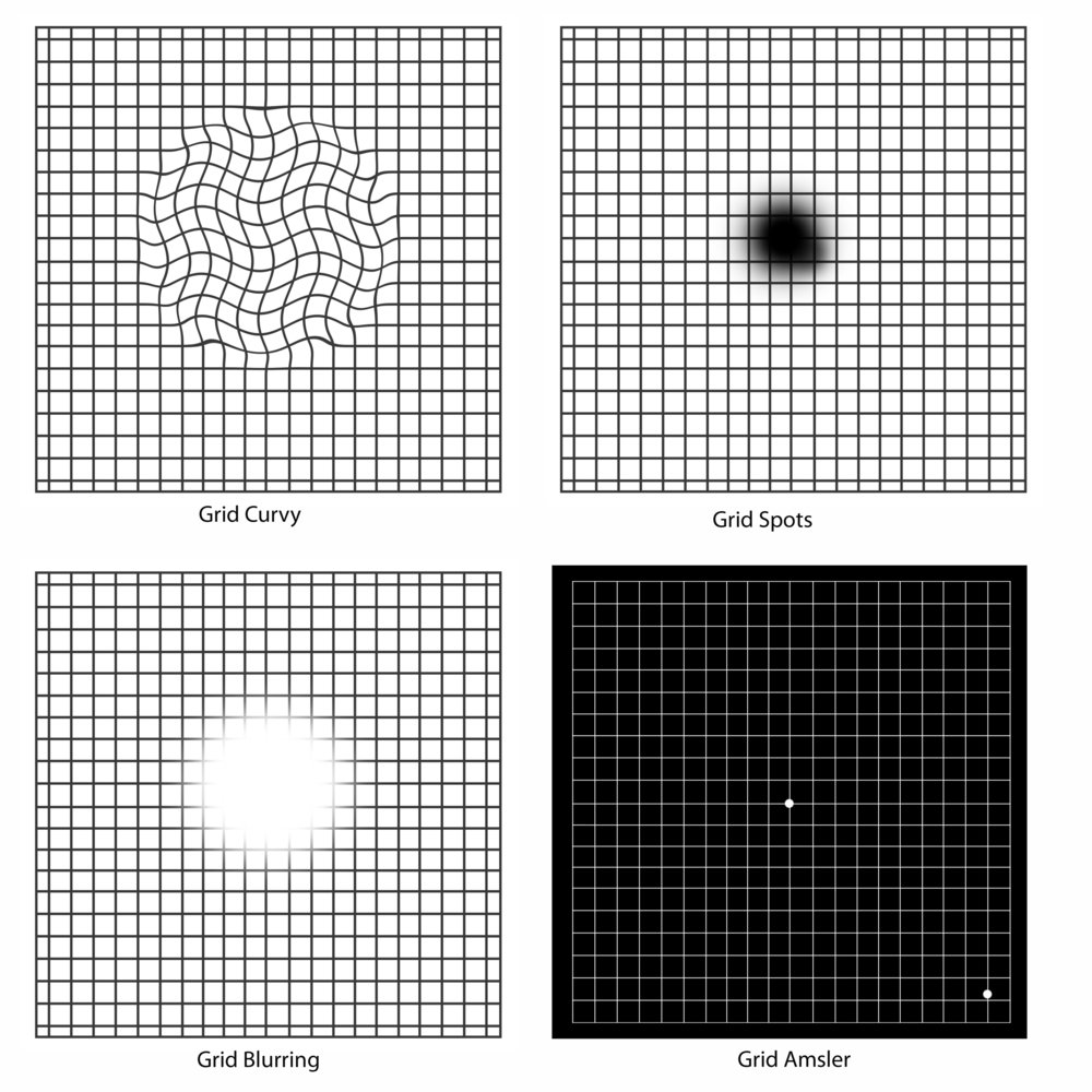 grid test for macular degeneration