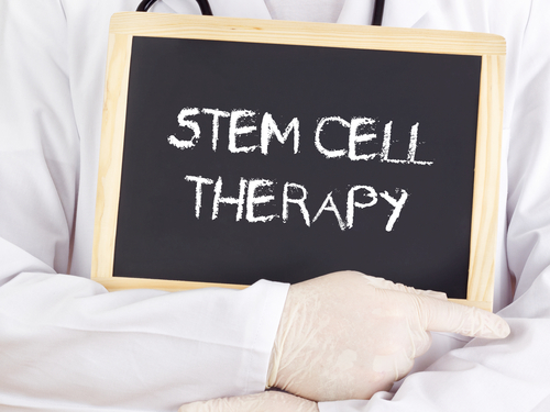 macular degeneration and stem cells